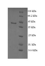 Non-specific lipid-transfer protein (SCP2), human, recombinant