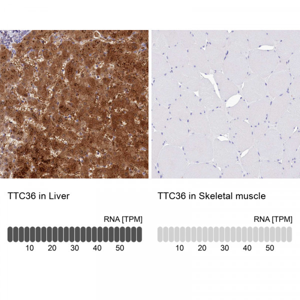 Anti-TTC36