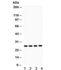 Anti-Flt3 ligand