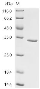Chaperonin GroEL (groEL), partial, recombinant Francisella tularensis subsp. holarctica