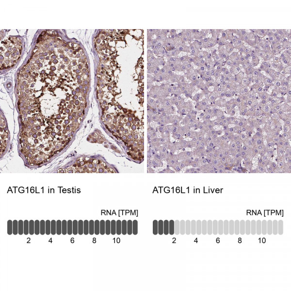 Anti-ATG16L1