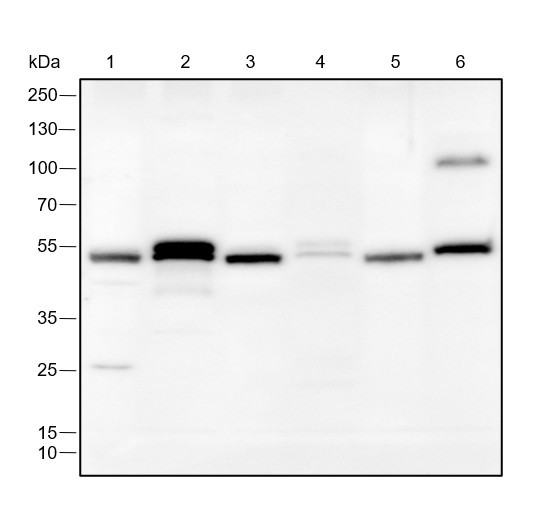 Anti-Recombinant FLI1, clone A222
