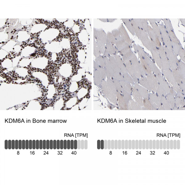 Anti-KDM6A
