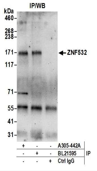 Anti-ZNF532