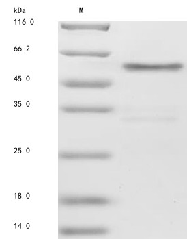 Protein jagged-1 (JAG1), partial, human, recombinant
