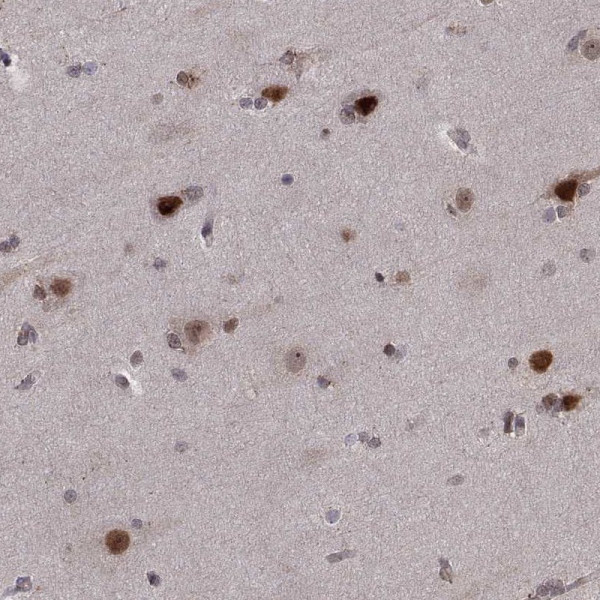Anti-PSMC2