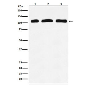 Anti-PI 3 Kinase p110 delta / PIK3CD, clone ADEO-16