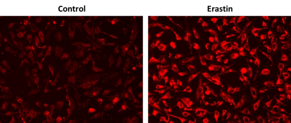 OxiVision(TM) Red Mitochondrial Lipid Peroxidation Sensor
