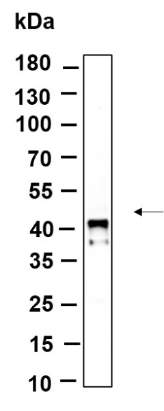Anti-Recombinant Phospho-IkappaB-alpha (Ser32), clone 9D8