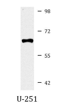 Anti-GRK5