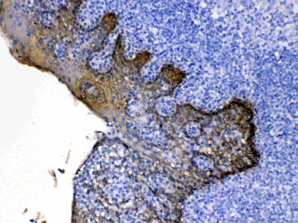 Anti-Cytokeratin 5