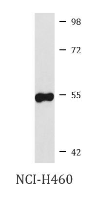 Anti-DHCR24 / Seladin-1