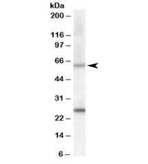 Anti-COL4A3BP