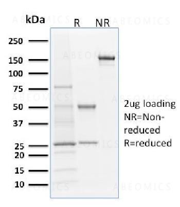 Anti-Langerin / CD207 (Marker of Langerhans Cells) Monoclonal Antibody (Clone: LGRN/1821)