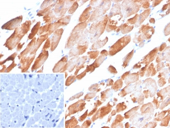 Anti-TPM1 / Tropomyosin-1 / Alpha Tropomyosin, clone TPM1/4510