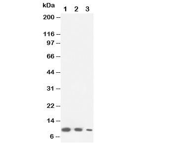 Anti-Lymphotactin