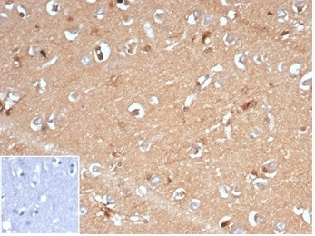 Anti-AKR1B1 / Aldose reductase (recombinant antibody), clone AKR1B1/7009R