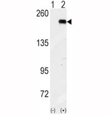 Anti-GCN2