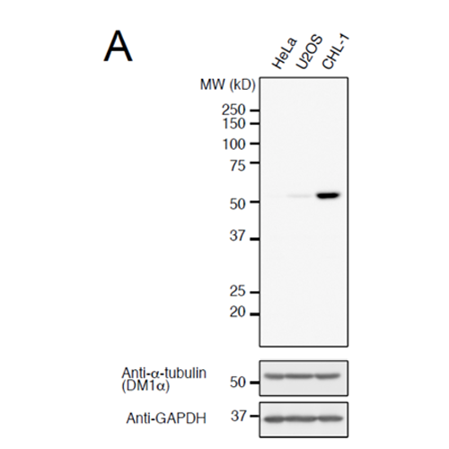 Anti-detyrosinated-alpha-Tubulin (human), Rabbit Monoclonal (RM444)