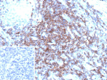 Anti-CD3 delta / CD3D, clone CD3D/13089R