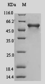 Mucosal addressin cell adhesion molecule 1 (Madcam1), partial, mouse, recombinant