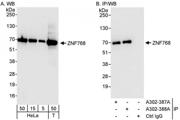 Anti-ZNF768