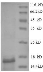 ESAT-6-like protein EsxB (esxB), Mycobacterium tuberculosis, recombinant