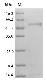 Transcriptional adapter 3 (TADA3), partial, human, recombinant