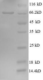 Golgi membrane protein 1 (GOLM1), partial, human, recombinant