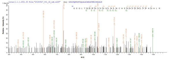 Meteorin (METRN), human, recombinant
