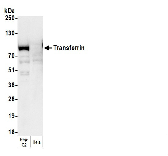 Anti-Human Transferrin, HRP conjugated