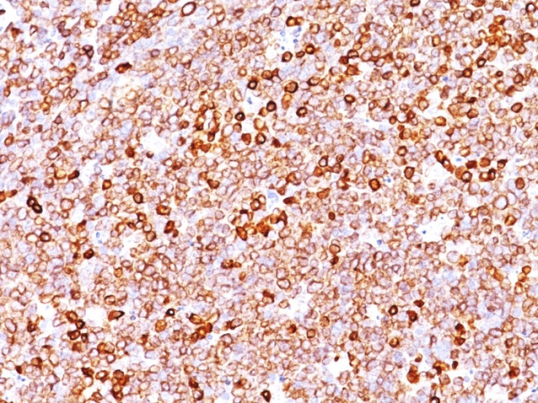 Anti-CD79a (B Cell Marker), clone JCB117 + HM47/A9