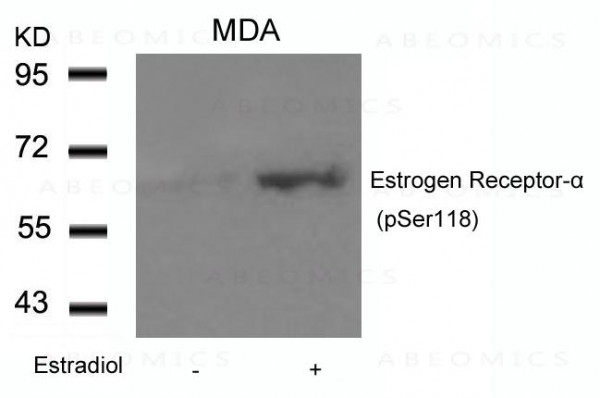 Anti-phospho-Estrogen Receptor- Alpha (Ser118)