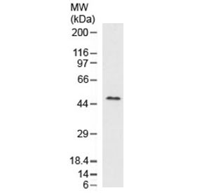 Anti-Adipophilin / Perilipin 2 / ADRP / PLIN2, clone ADPN1-2R