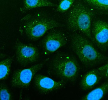 Anti-THEM6 / Thioesterase superfamily member 6
