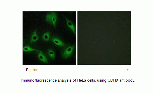 Anti-CDH9