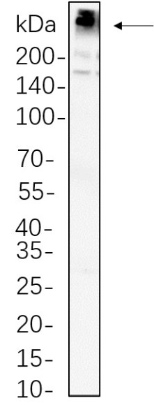 Anti-Recombinant Fatty Acid Synthase, clone 2D7