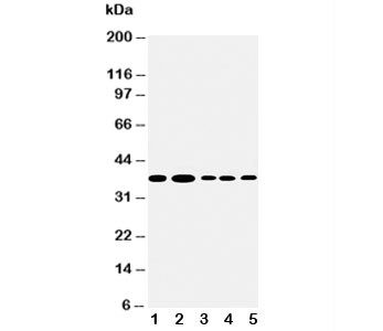 Anti-Angiopoietin 2