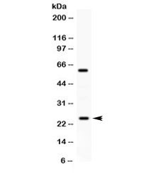 Anti-RAB11A