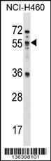 Anti-MEX3B, NT (MEX3B, KIAA2009, RKHD3, RNF195, RNA-binding protein MEX3B, RING finger and KH domain