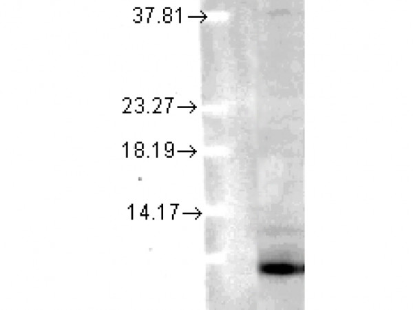 Anti-Ubiquitin, clone 6C11-B3