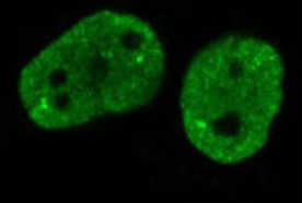 Anti-CEBP beta