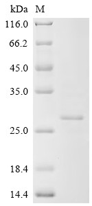 Protein UL16 (UL16), partial, human cytomegalovirus, recombinant