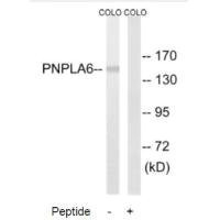 Anti-PNPLA6