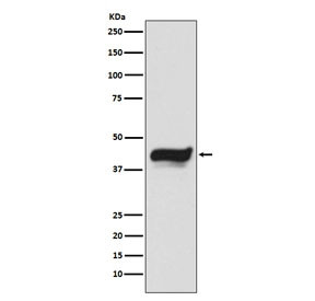 Anti-IKB epsilon / NFKBIE, clone ADCF-14