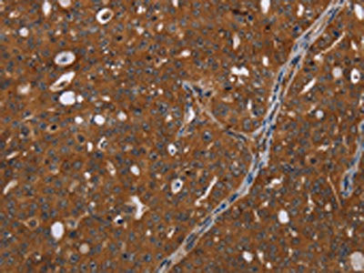 Anti-HDAC7