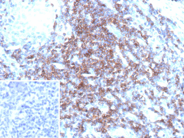 Anti-CD3D / T Cell Receptor delta, recombinant antibody, clone CD3D/13089R