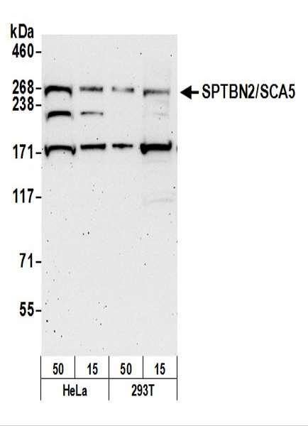 Anti-SPTBN2/SCA5