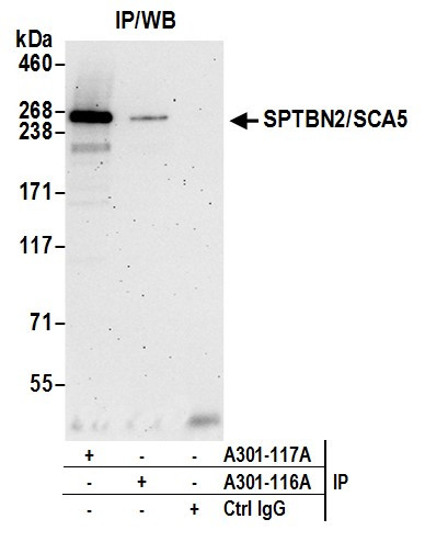 Anti-SPTBN2/SCA5