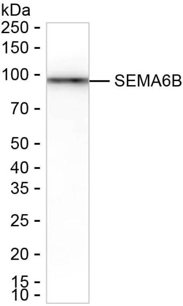 Anti-SEMA6B